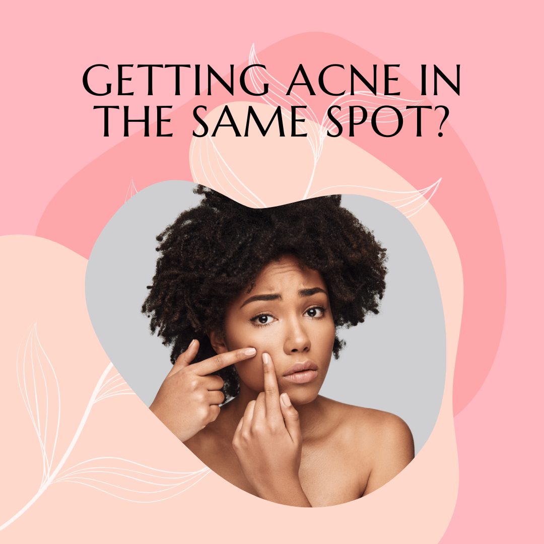 Why do you keep getting Acne in the same spot?